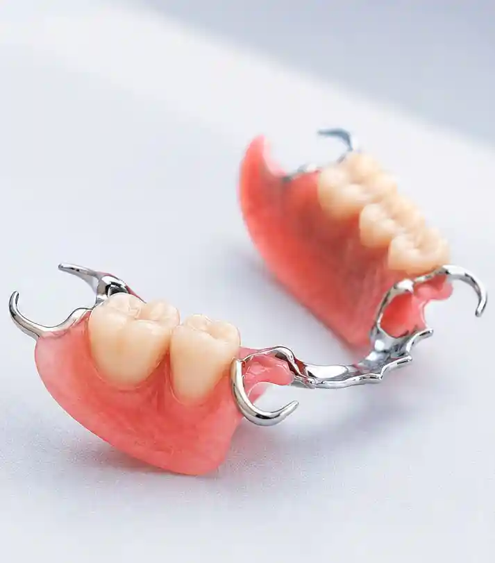 Qué es una prótesis dental — tipos y materiales