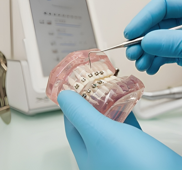 Clinica Dr. Sancho Prótesis sobre implantes